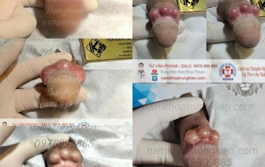 Cách Kích Thích Điểm G Của Phụ Nữ Khiến Nàng Lên Đỉnh Dễ Dàng 