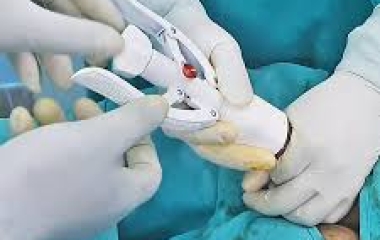 Phẫu thuật cắt bao quy đầu: Giải pháp toàn diện cho sức khỏe của nam giới