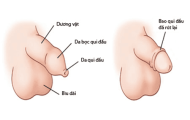 Khám phá lợi ích của cắt bao quy đầu: Giải pháp cho sức khỏe nam giới