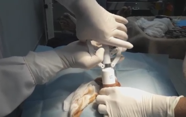 Cắt bao quy đầu gần đây: Địa chỉ uy tín và những điều cần biết