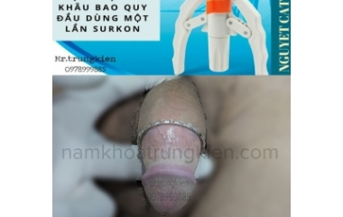 Cắt Bao Quy Đầu Khi Nào Lành?