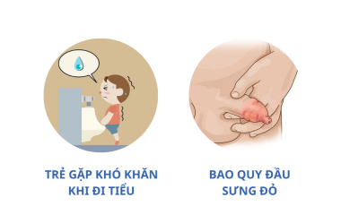 CẮT BAO QUY ĐẦU: Dành cho trẻ em hay người lớn? Tư vấn từ chuyên gia