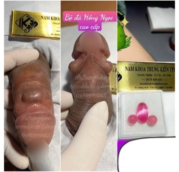 Bộ 3v Bi Đá Nam Khoa cao cấp đá Hồng Ngọc 