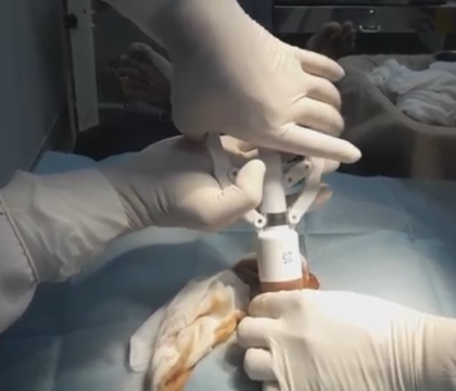 Cắt Bao Quy Đầu - Lợi Ích Sức Khỏe và Đời Sống Tình Dục Cho Nam Giới