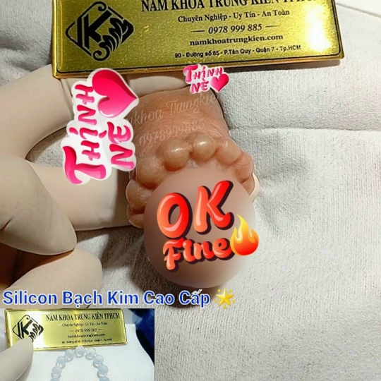 Chuỗi bi bạc đạn silicon bạch kim cao cấp