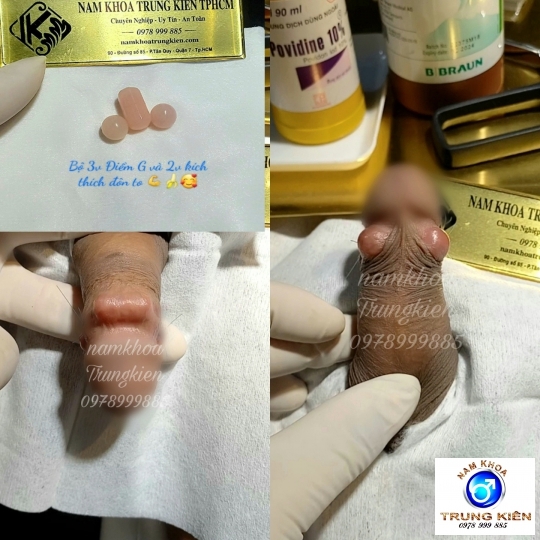 Hình ảnh cắt bao quy đầu an toàn 100% ko Đau