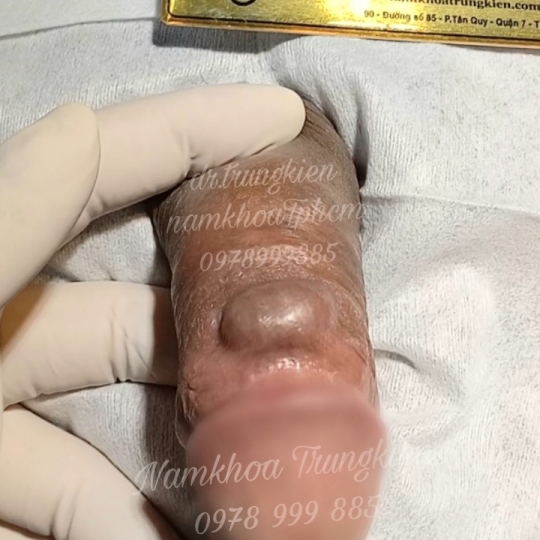 Chuỗi bi bạc đạn silicon bạch kim cao cấp