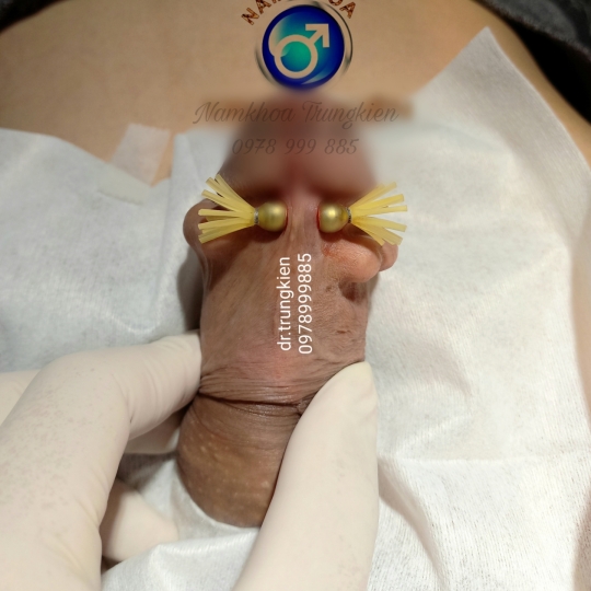 Chuỗi bi bạc đạn silicon bạch kim cao cấp