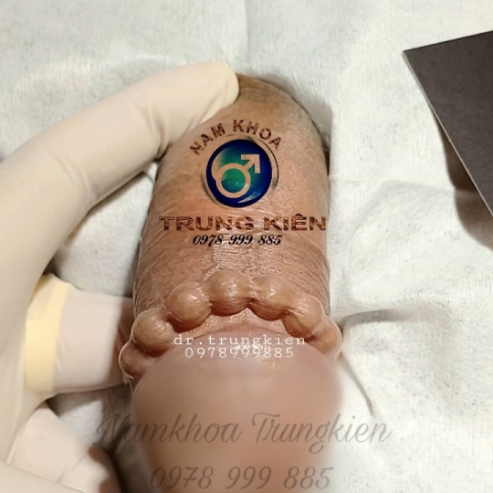 Cấy Bi Full cho Cậu Nhỏ 