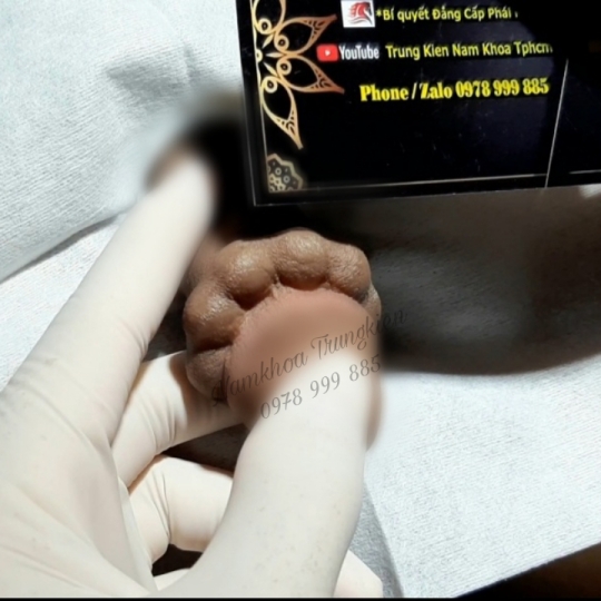 Chuỗi bi bạc đạn silicon bạch kim cao cấp