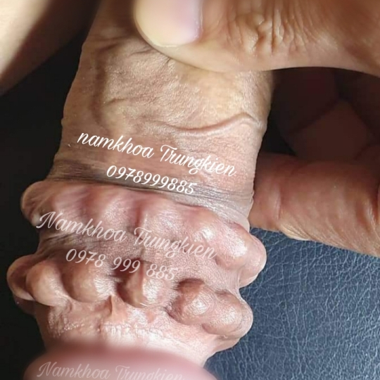 Chuỗi bi bạc đạn silicon bạch kim cao cấp