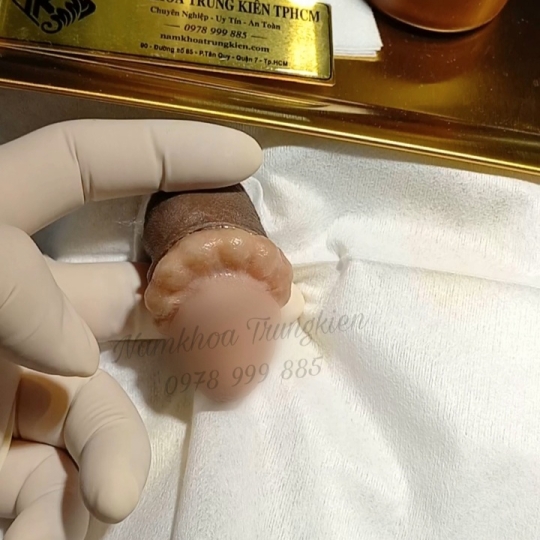 Các sản phẩm Bi đá cao cấp nam khoa chuyên nghiệp An toàn tuyệt đối