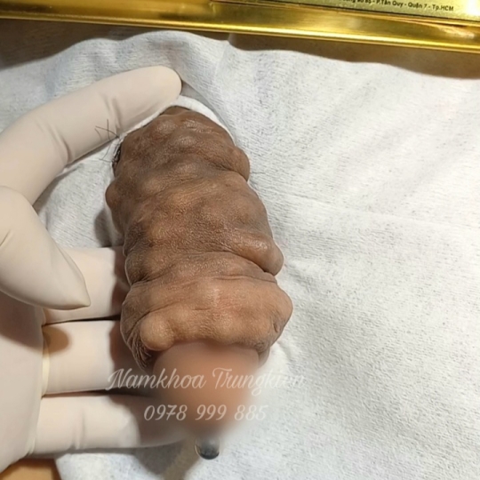 Chuỗi bi bạc đạn silicon bạch kim cao cấp