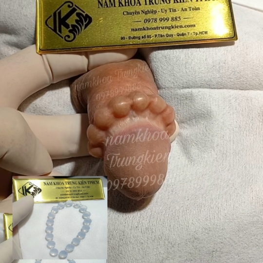 Gắn Bi bộ 3 viên điểm G mang lại cảm giác tuyệt vời 