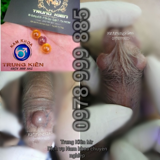 Hình ảnh gắn bi cậu nhỏ