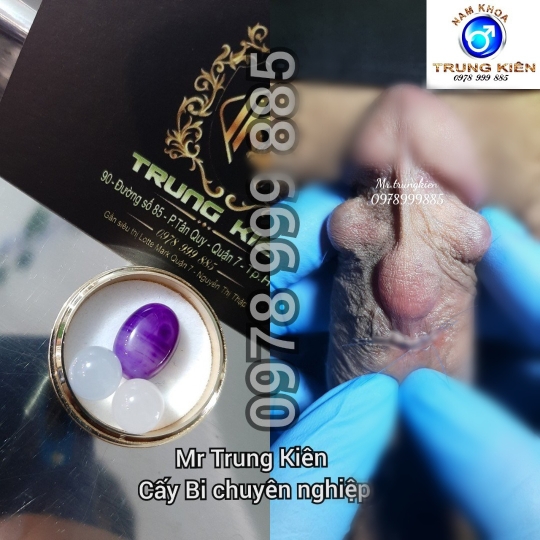 Chuỗi bi bạc đạn silicon bạch kim cao cấp