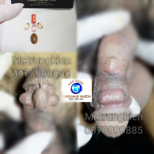 Hình ảnh gắn bi cậu nhỏ