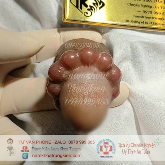 Các sản phẩm Bi đá cao cấp nam khoa chuyên nghiệp An toàn tuyệt đối